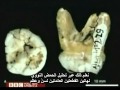 اكتشاف جنس جديد من البشر -