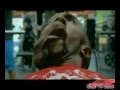 مرض نادر- رجل يسقط نصف وجهه