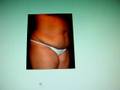tummy tuck-abdominoplasty-dr. kamal saleh-al emadi hospital-