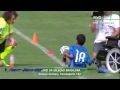 طفل مُعاق يتحدى نجوم البرازيل بمهاراته الكروية في مشهد مؤثر