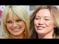 لن تتخيل شكل الفنانات العربيات والعالميات قبل البوتكس وبعده...جديد 2014