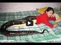 الطفلة الثعبان التي اثارت الرعب