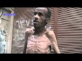 شهادات صادمة لسوري حي ميّت من الجوع باليرموك